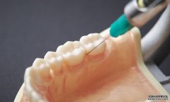 <b>单颗种植牙价格减半！医保部门今蓝冠代理起展开种植牙价格综</b>